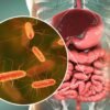 Colorectal cancer is on the rise especially in young adults under 54